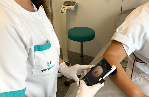 La detección precoz y la protección solar son los mejores escudos para salvar vidas frente al cáncer de piel La detección precoz y la protección solar son los mejores escudos para salvar vidas frente al cáncer de piel